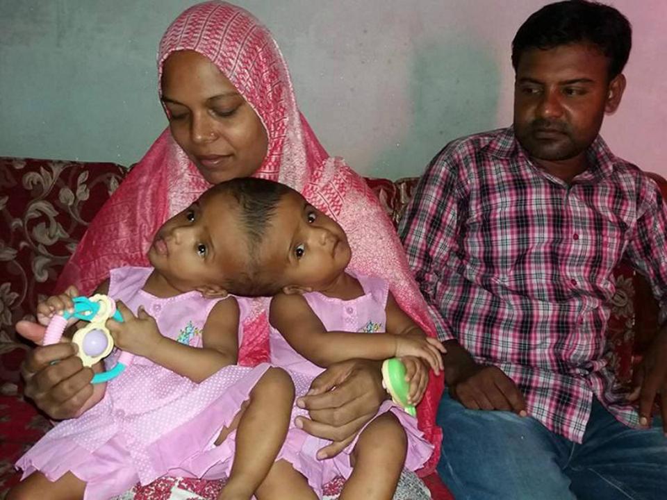  Mum Taslima and her husband Mohammad were told they were expecting one baby with a big head, after a series of routine scans during pregnancy