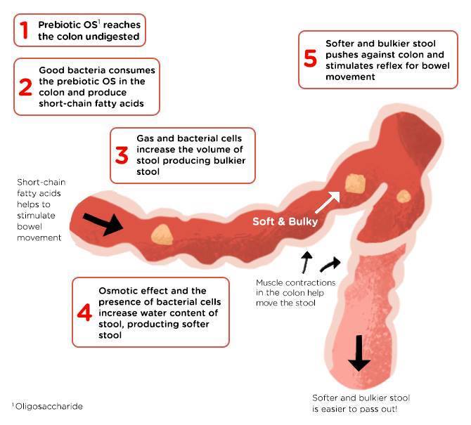 constipation in children