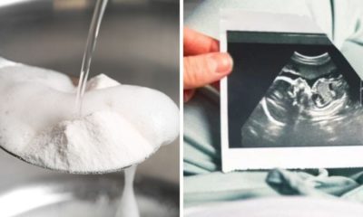 Baking Soda Pregnancy Test: How Reliable Is It Really?