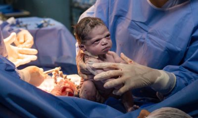 Newborn Baby Makes Epic Face In Viral Birth Photo