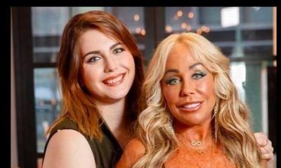 Mom and daughter had plastic surgery together for bonding