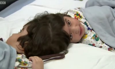 Conjoined Twins Finally Home After Successful Operation