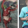 Miracle Preemie Born the Size of 12-Inch Superman Celebrates Every Birthday Posing With Same Toy