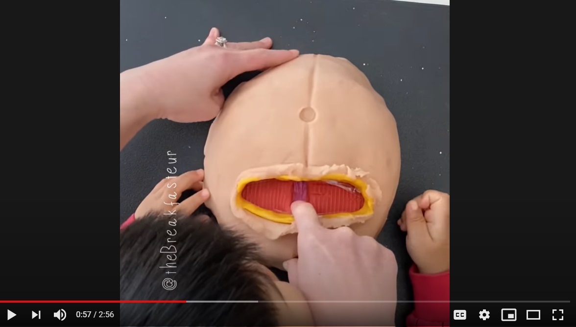 [WATCH] Doctor Mom Teaches 4-Year-Old Child About C-Section Births Using Play-Doh