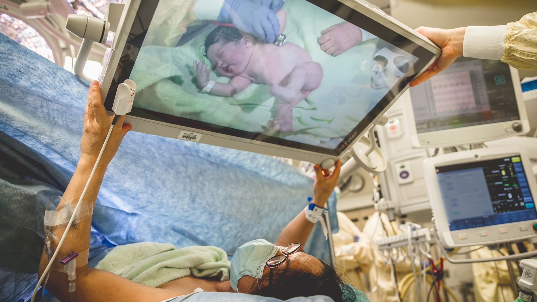 18 Stunning Birth Photos That Show The Power Of C-Section Moms
