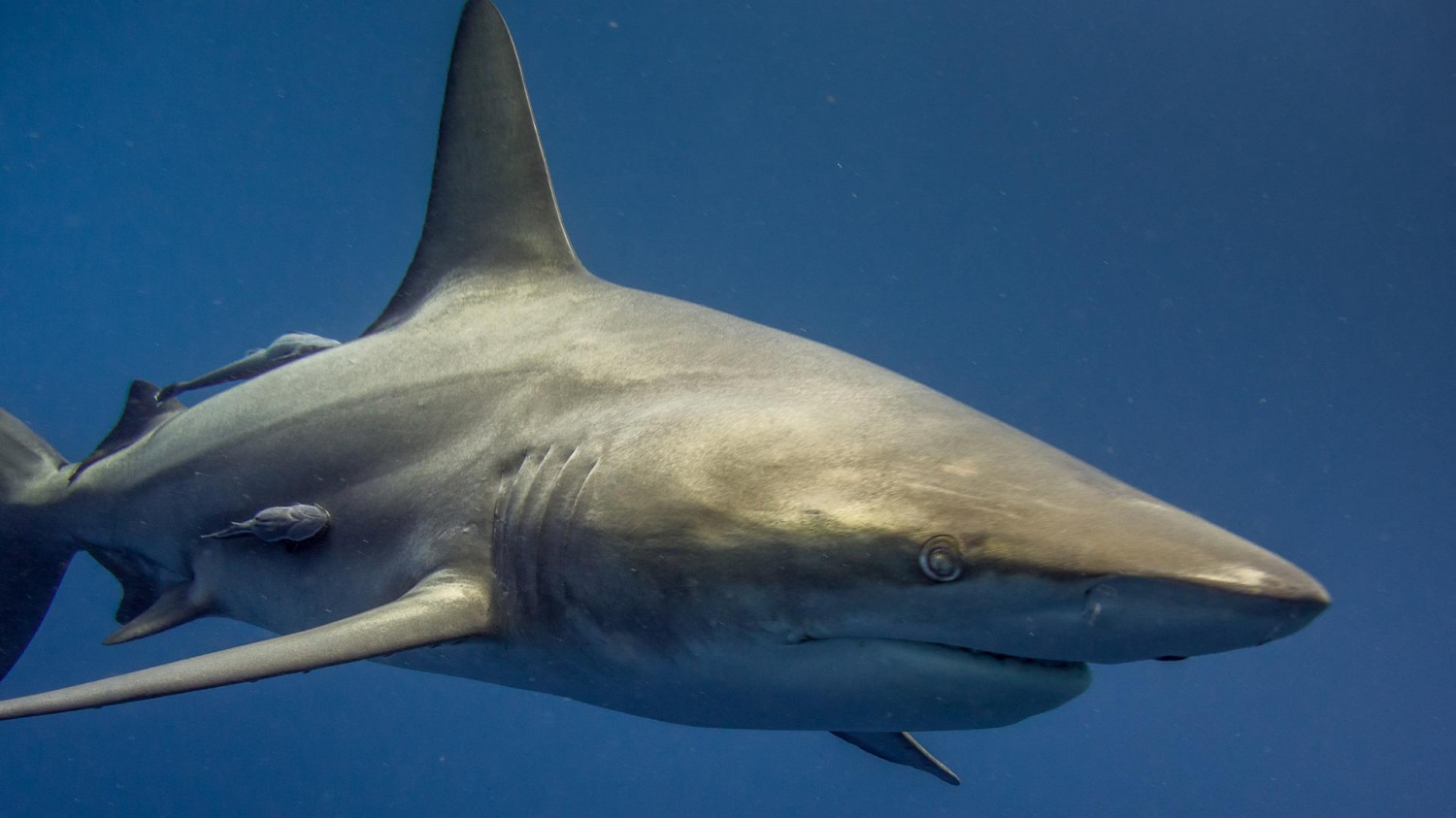 11-Year-Old Boy Says He's Happy To Be Alive Recalling Moments a Bull Shark Bit Him