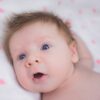 Cross-Eyed Babies: Early Treatment Is the Key