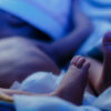 What Happens When Your Newborn Has Jaundice - Pregnancy & Newborn Magazine