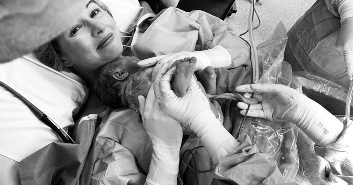 Some People Are Actually Participating In Their Own C-Sections. Here's How It Works.