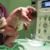 Father Files $642 Million Lawsuit Against Hospital, Claims C-Section Viewing Triggered His Psychotic Illness