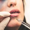 Youth Under 18s Flock to Wales for Botox Following Ban in England