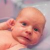 Aquaphor for Cradle Cap: A Parent’s Guide to Effective Treatment