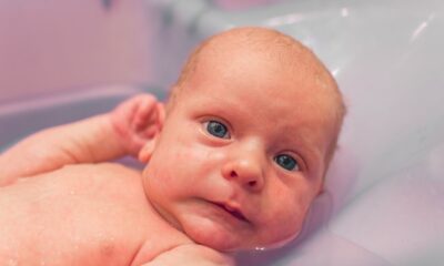 Aquaphor for Cradle Cap: A Parent’s Guide to Effective Treatment