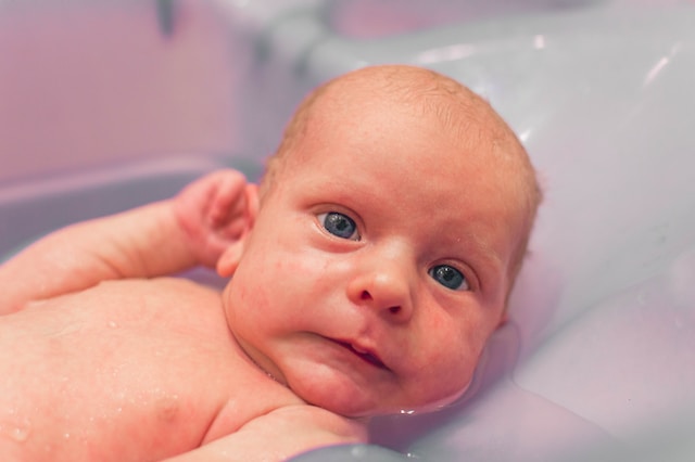 Aquaphor for Cradle Cap: A Parent’s Guide to Effective Treatment