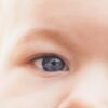 Baby's Eye Red in the Corner: Causes and Care Tips for Concerned Parents