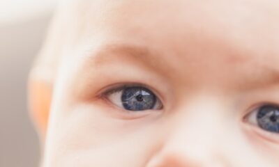 Baby's Eye Red in the Corner: Causes and Care Tips for Concerned Parents