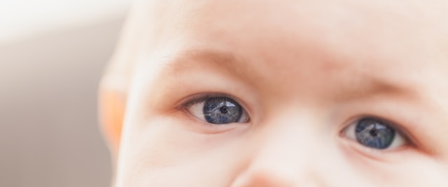 Baby's Eye Red in the Corner: Causes and Care Tips for Concerned Parents