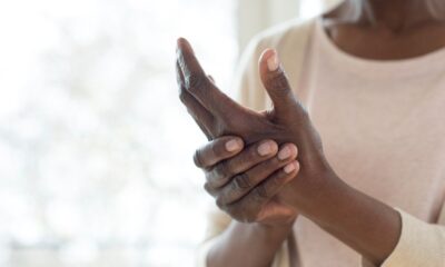 7 Early Signs Of Arthritis You Should Never Ignore