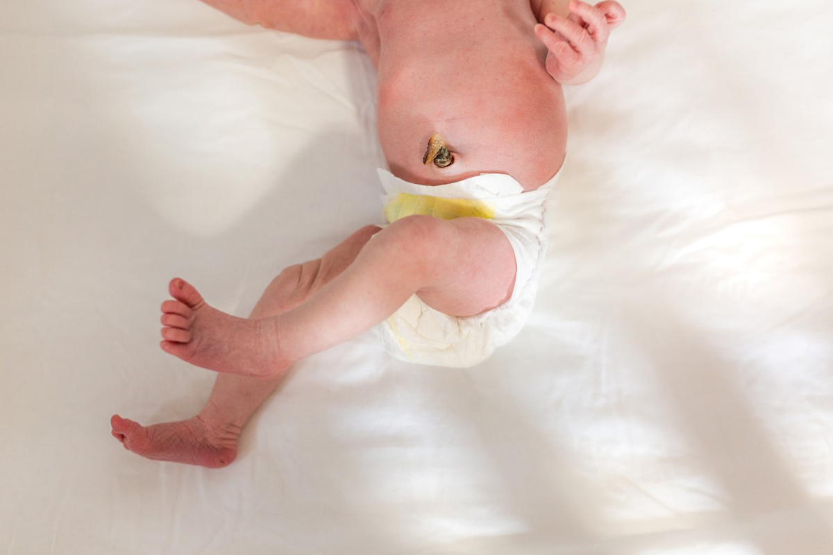 What Happens to Baby’s Umbilical Cord After Birth? - Pregnancy & Newborn Magazine