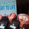 Arkansas Group To Gather Enough Signatures That Could Scale Back Abortion Ban in the State