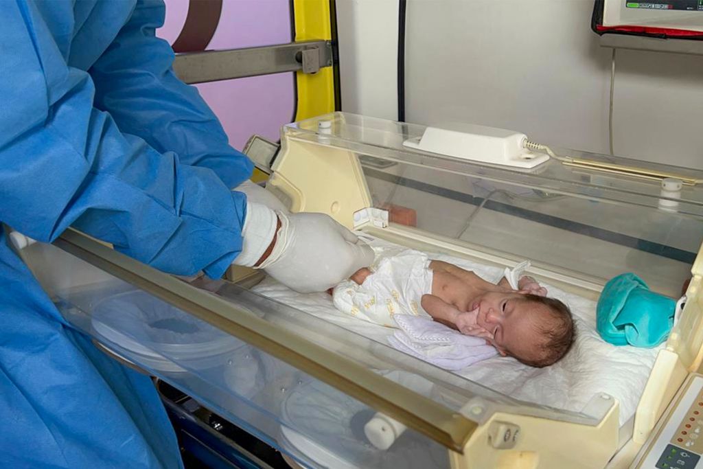 Twin Born Paper White While Other Baby Had Excess Red Blood Cells Due to Twin-to-Twin Transfusion Syndrome