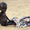 2 Million Children May Die of Malnutrition, Starvation Due to Shortage in Therapeutic Food Used To Treat Condition